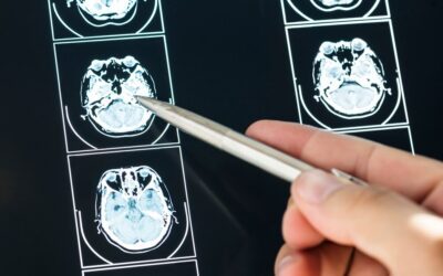 Postmortem Neurological Diagnostics: What You Need to Know About Brain-Only Autopsies