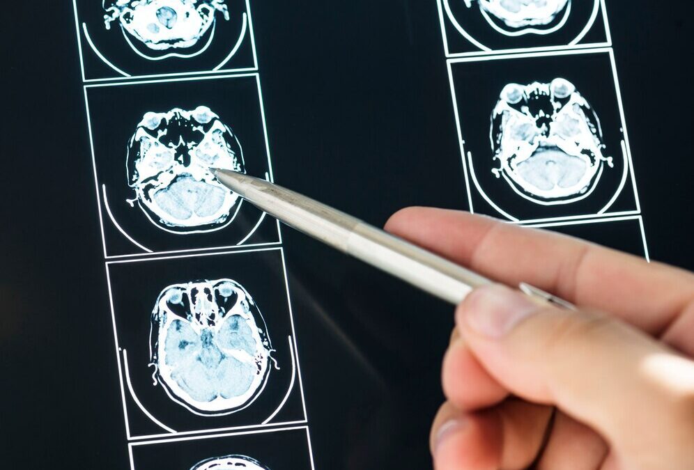 Postmortem Neurological Diagnostics: What You Need to Know About Brain-Only Autopsies