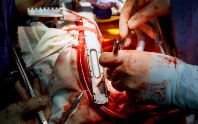 Second Opinion Autopsies: Why They Matter