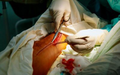 Exploring Partial Autopsies: Scope and Limitations